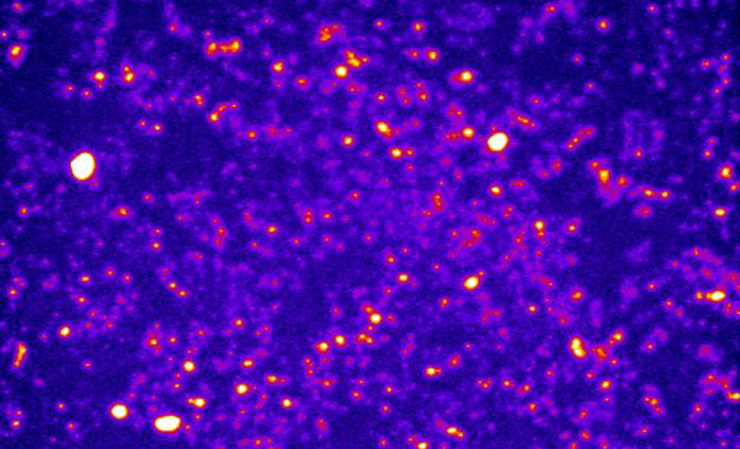 Microscope image detecting near-infrared emission from fluorescent nanoparticles taken up by human lung cancer cells