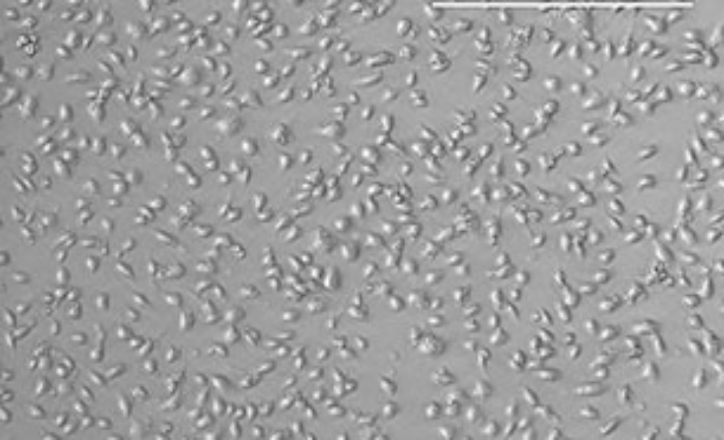 Purification of M5-encoded protein