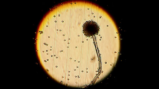 Aspergillus flavus spores and conidiophores under the microscope